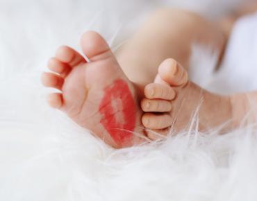 baby-foot-with-red-kiss-mark-733878.jpg Гемангиомы недоношенных